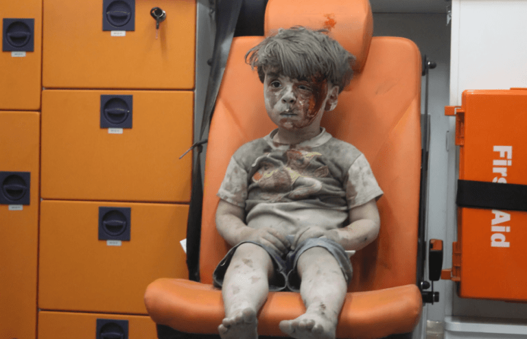 صورته هزت العالم.. الطفل عمران دقنيش يعود ليروي حكاية سوريا