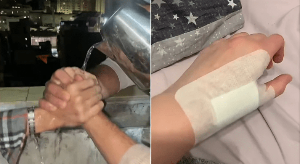 تحدي الماء المغلي تيك توك